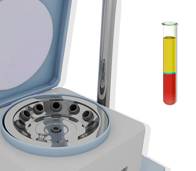 Platelet-Rich Plasma (PRP) Injection