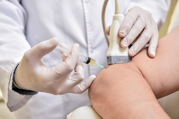 What Is PRP Treatment and How Does It Help Patients in Boca Raton, Boynton Beach & Delray Beach, FL?